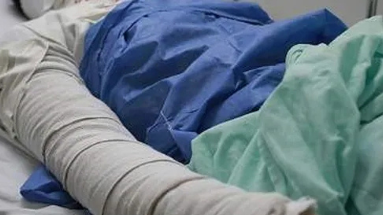 La mujer de 55 años estaba en terapia tras un accidente de tránsito. Su hermano le alcanzó un encendedor y un cigarrillo, lo que derivó en un incendio que le provocó quemaduras fatales.