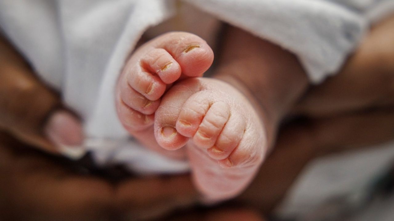 El niño padece una parálisis cerebral grave. Dependerá de cuidados constantes durante toda la vida.