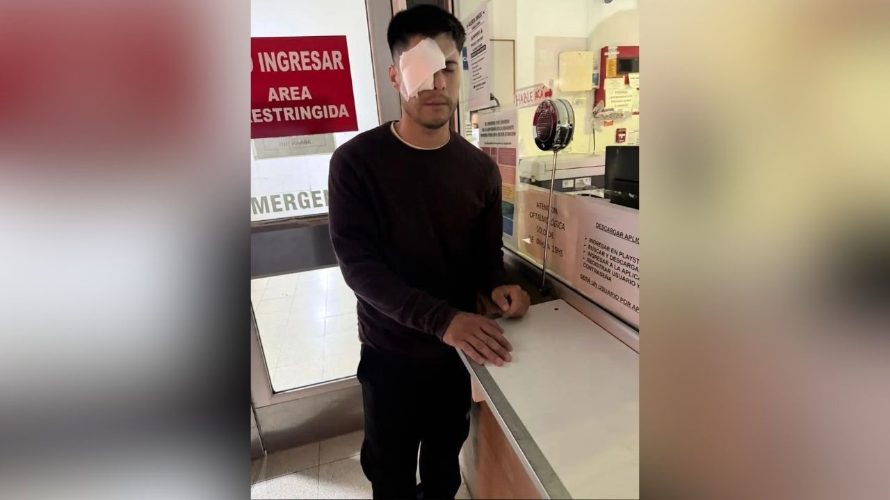 La compañía de seguros de la empresa a cargo del evento alcanzó un acuerdo extrajudicial con la víctima.